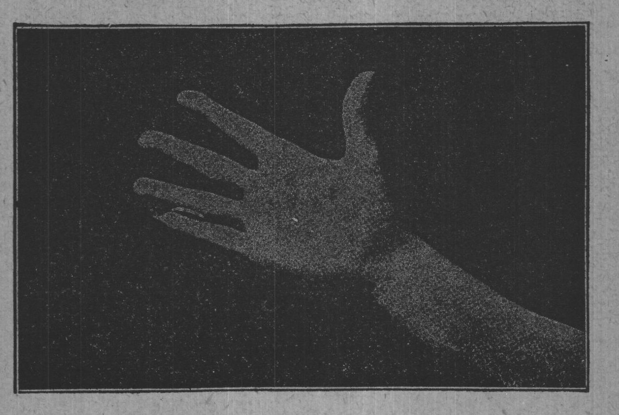 Fig. 8.