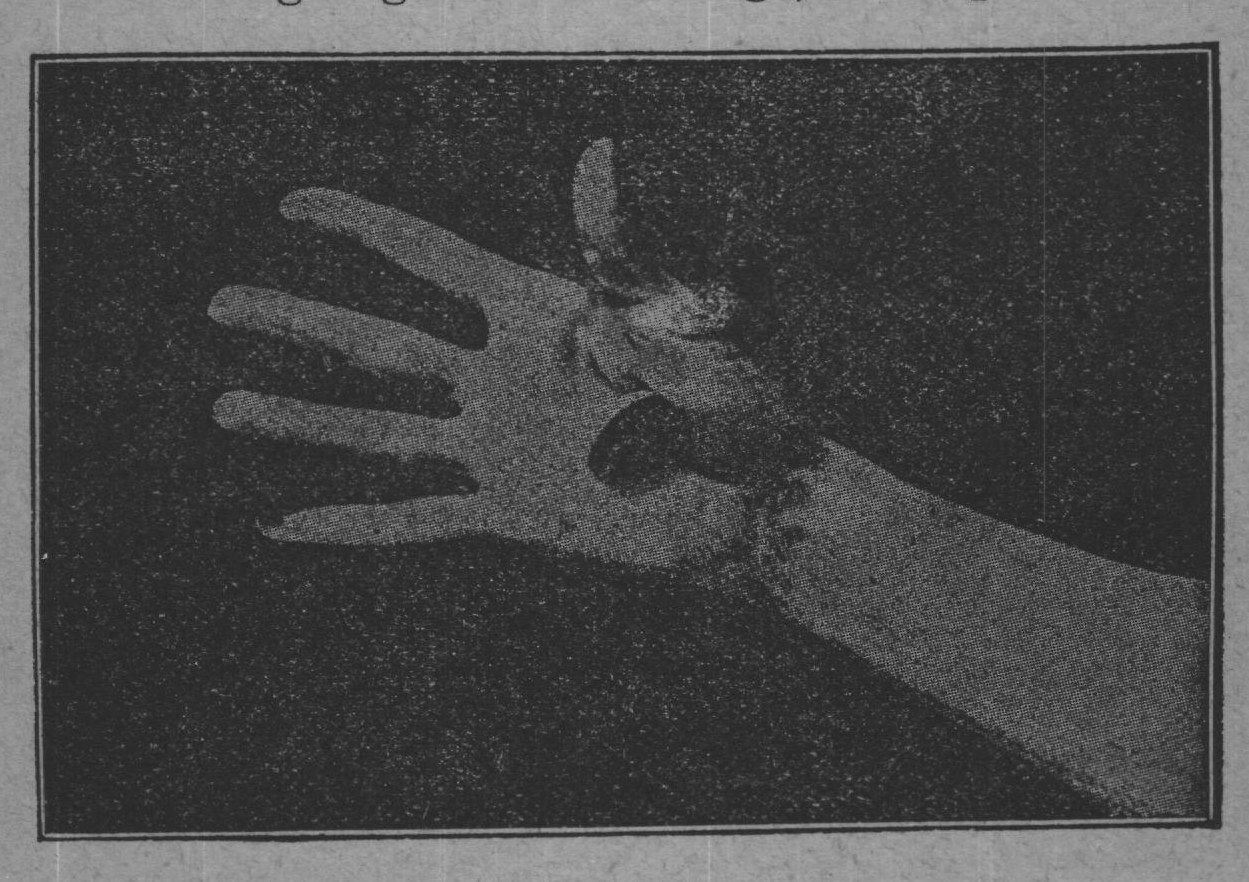 Fig. 9.