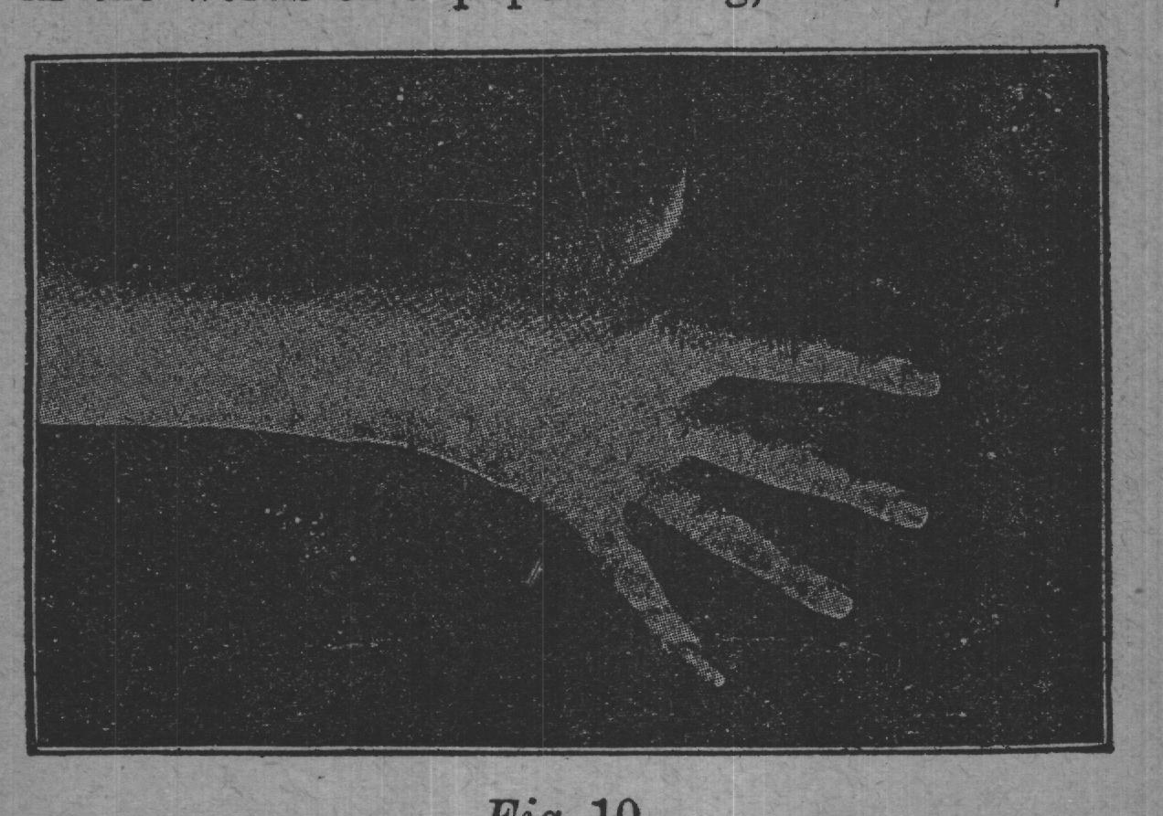 Fig. 10.