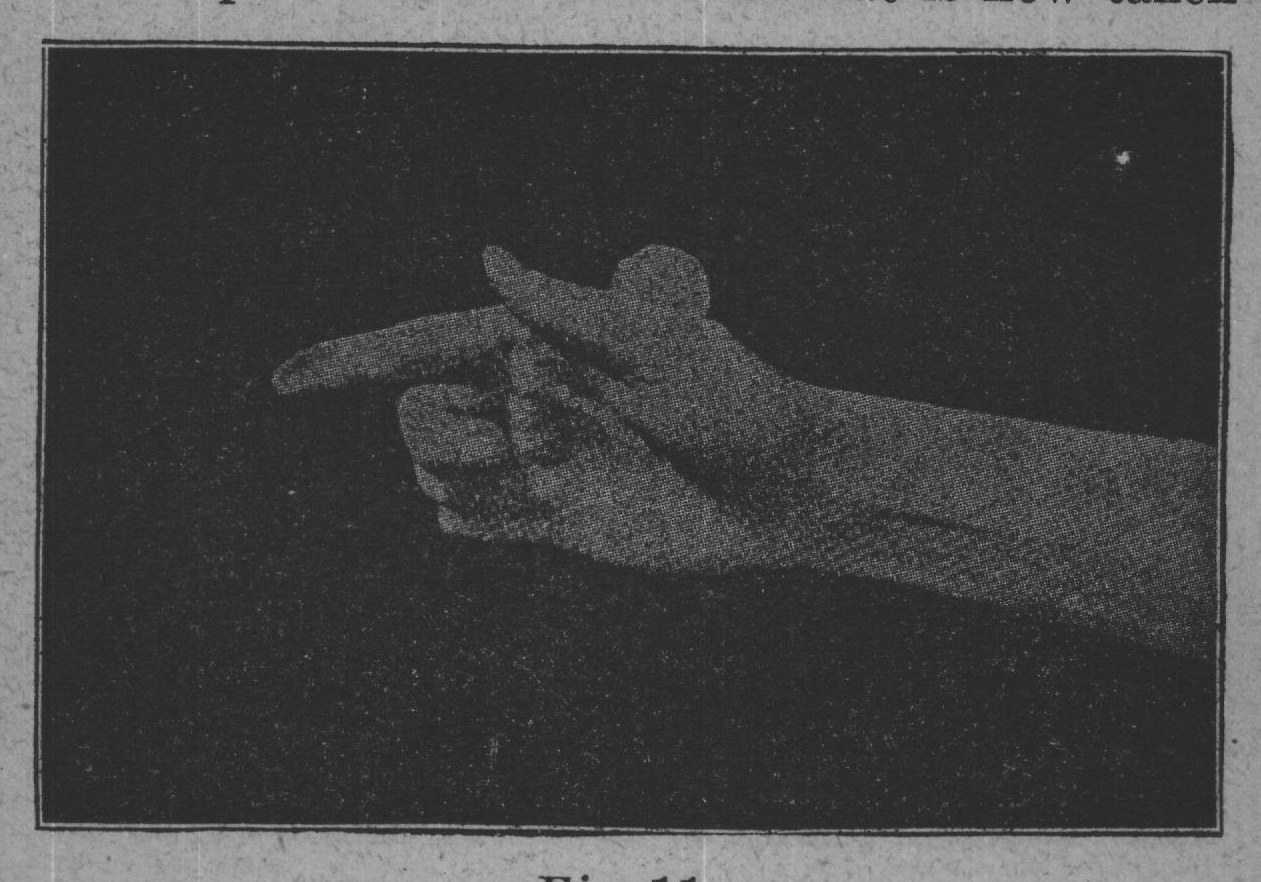Fig. 11.