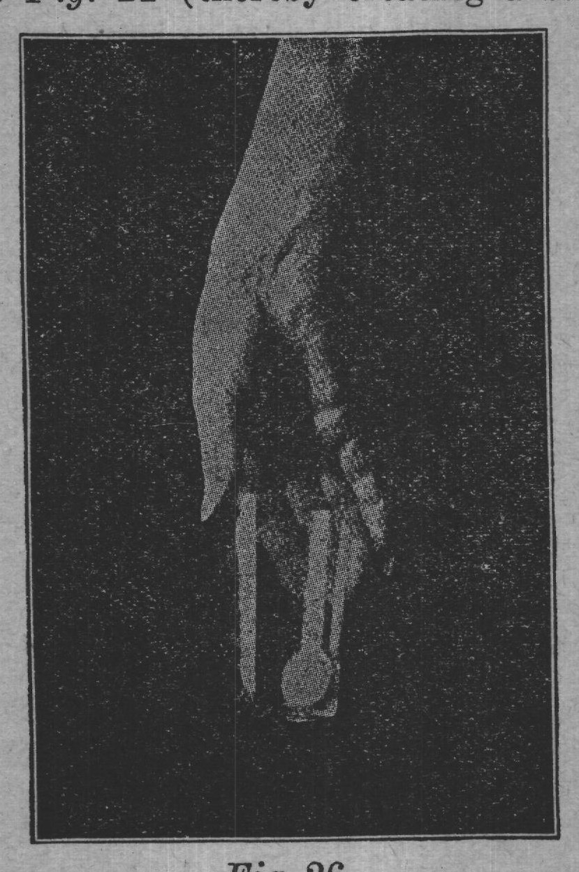Fig. 26.