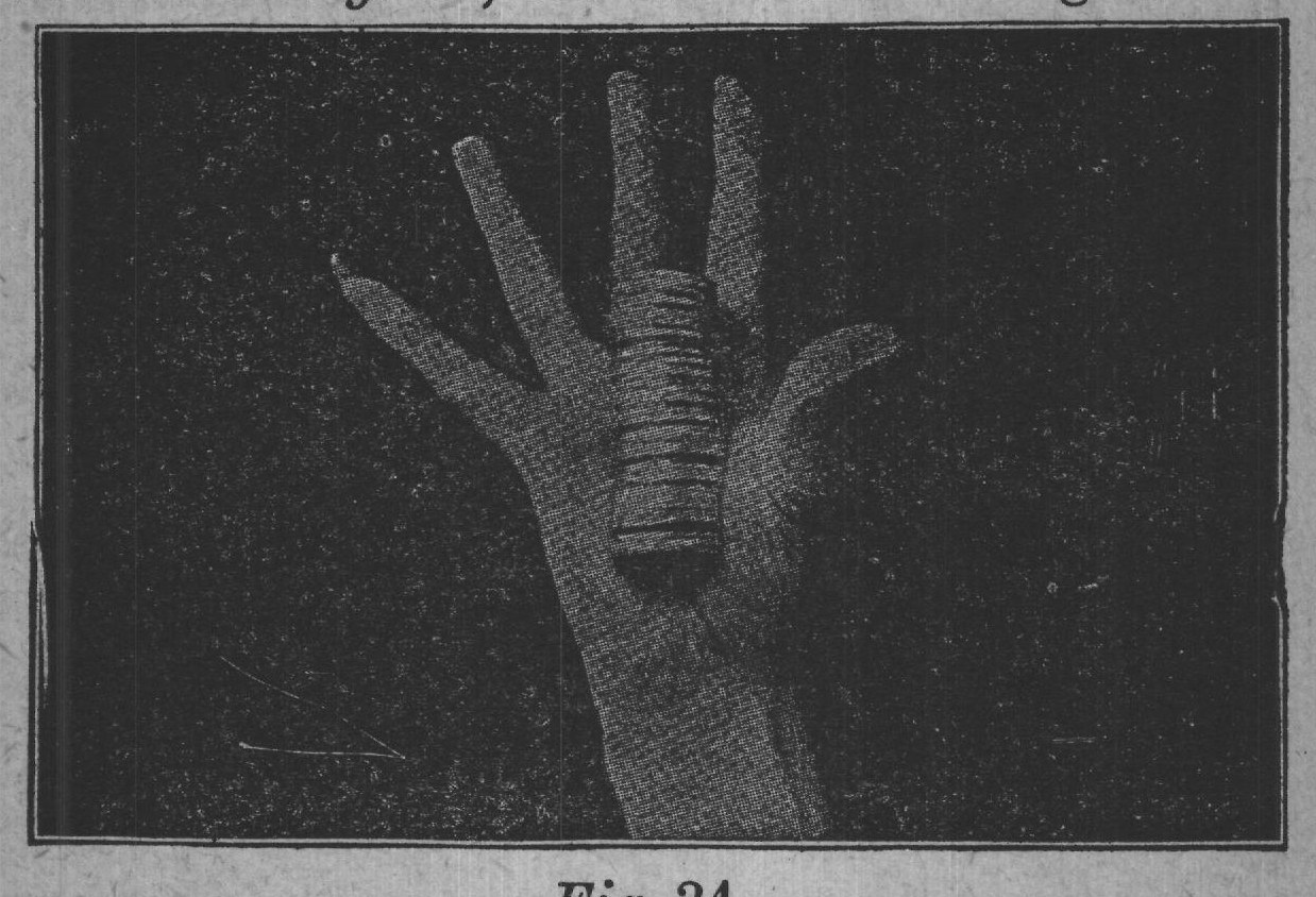 Fig. 34.