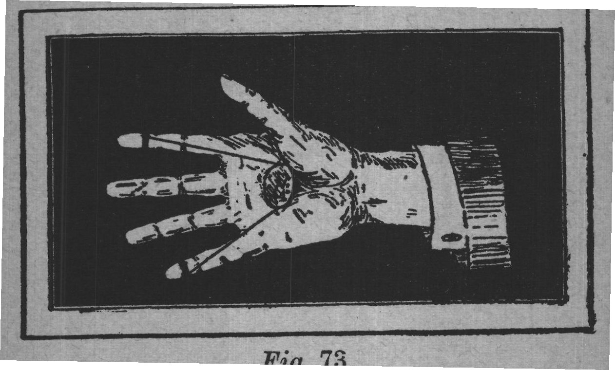 Fig. 73.